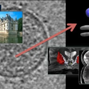 and Processing: From Mars to Hollywood with a Stop at the Hospital preview image
